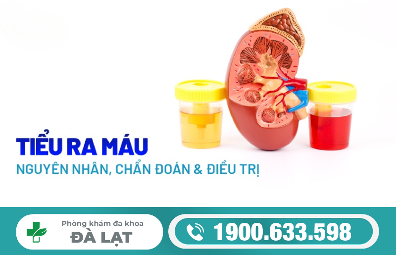 Hình ảnh minh họa
